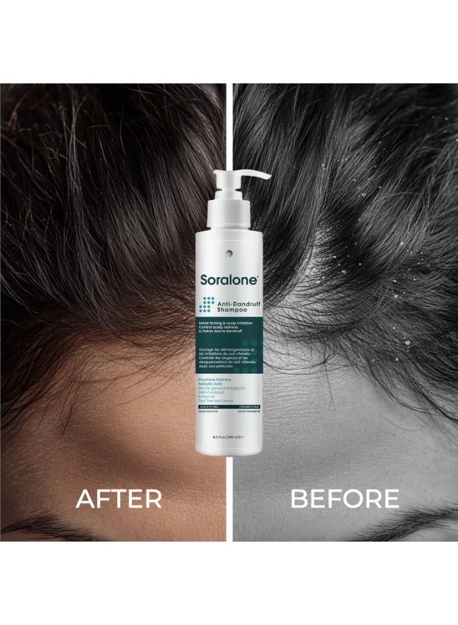 soralone shampoo Anti-dandruff - Image 3